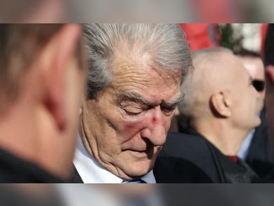 Watch: Albanian Leader Punched In Face While Leading Protest